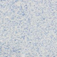 Декоративная штукатурка  РЕЛЬЕФ  326